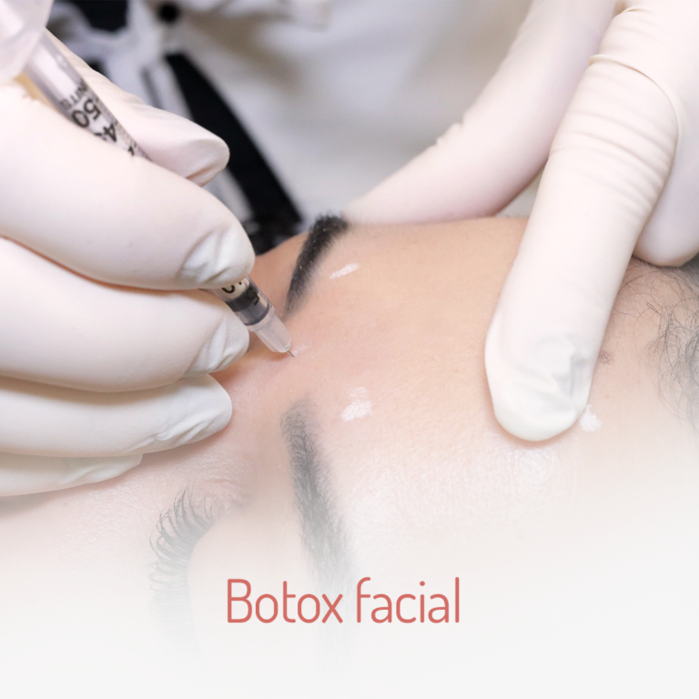 Botox-facial