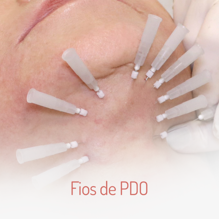 Fios-de-pdo