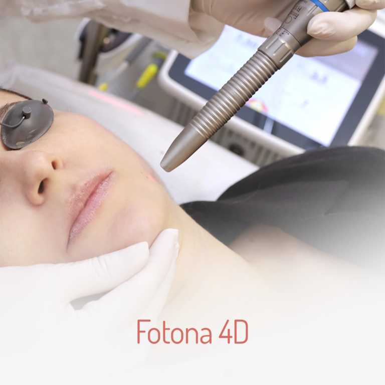 Fotona-4D