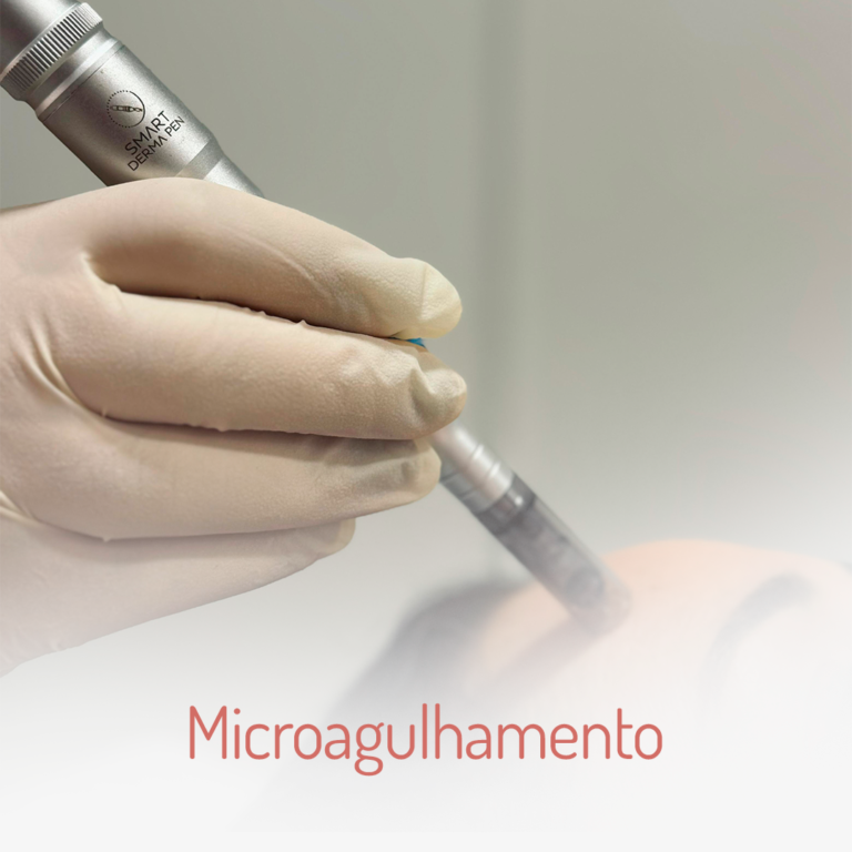 Microagulhamento