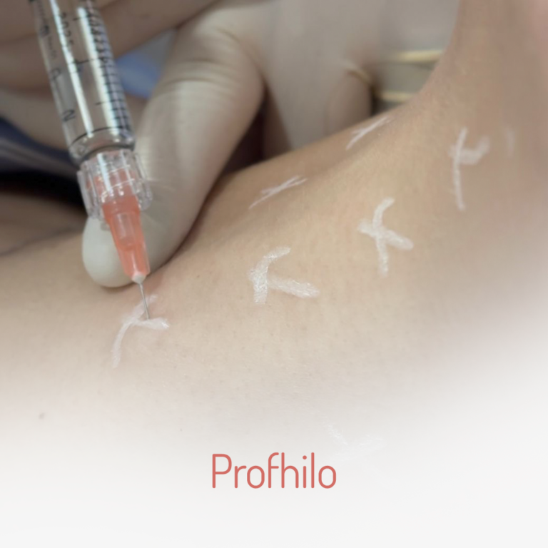 Profhilo