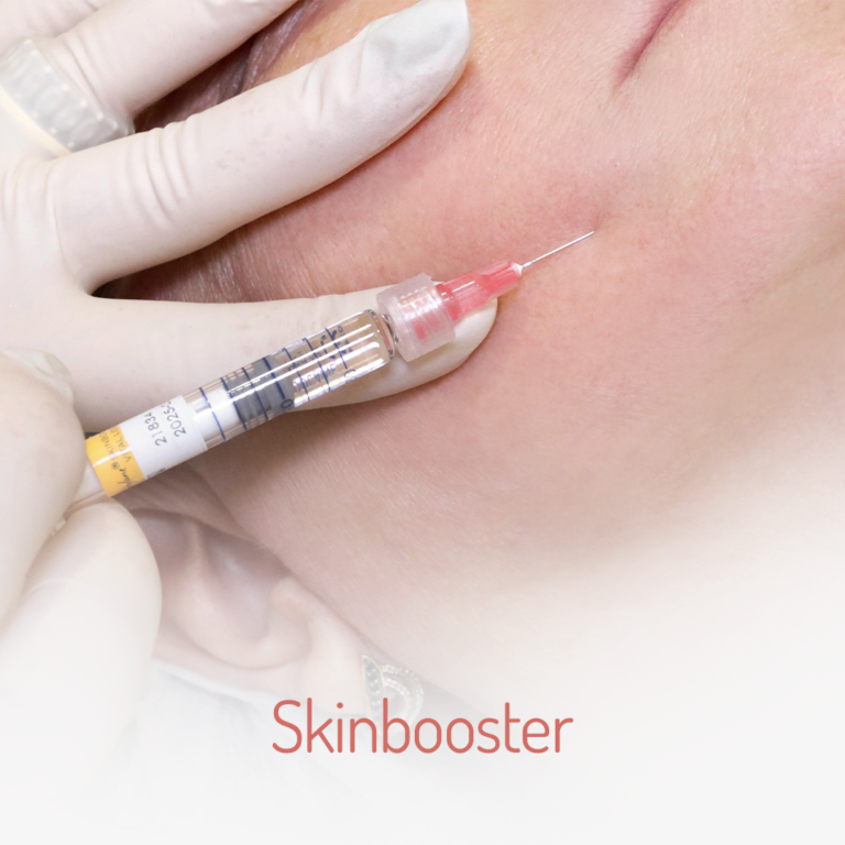 skinbooster